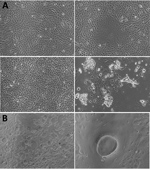 Thumbnail of Cytopathic effect (CPE) of Nipah virus from throat swab samples of a patient in Kerala, India, 2018. Virus was inoculated into Vero CCL81 cells. A) CPE at postinfection days 1 (top) and 2 (bottom). Left panels depict the control cell; right panels depict the NiV-infected cell. B) NiV-infected cells. Original magnification ×10.