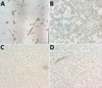 Cytopathic effect in monkeypox virus–infected cells from patients in Asturias, Spain. A) MRC-5; B) Vero E6; C) A549; D) LLC-MK2. Original magnification ×10.