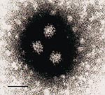 Thumbnail of Electron microscopy showing NLV particles in a calf herd sample (CH176), negatively stained with 2% K-PTA, pH 7.0. Bar = 50nm.