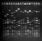 Thumbnail of Pulsed-field gel electrophoresis (PFGE) profiles of the 14 most common methicillin-resistant Staphylococcus aureus (MRSA) strain types identified, Finland, 1997–1999. Lanes 1, 9, 17: S. aureus NCTC 8325 (molecular weight marker); lanes 2–4: strain types associated with community acquisition (Mikkeli clone, E22, E31); lane 5: E1; lane 6: E24; lane 7: E5; lane 8: Kemi clone; lane 10: E27; lane 11: UK EMRSA-15; lane 12: E19; lane 13: Pori clone; lane 14: E20; lane 15: Iberian clone; and lane 16: O25.