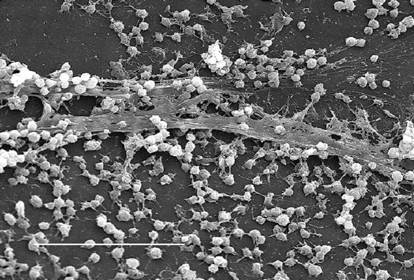 Scanning electron micrograph of a staphylococcal biofilm on the inner surface of an indwelling medical device. Bar, 20 μ. Used with permission of Lippincott Williams &amp; Wilkins.