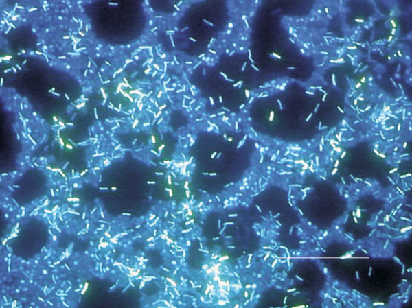 Polymicrobic biofilm grown on a stainless steel surface in a laboratory potable water biofilm reactor for 14 days, then stained with 4,6-diamidino-2-phenylindole (DAPI) and examined by epifluorescence microscopy. Bar, 20 μ.