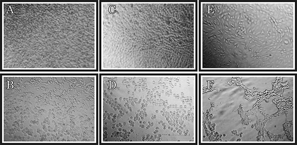 Image of mammalian cell lines injected with extracts from healthy shrimp: A, human rhabdomyosarcoma (RD), Cep-2C, BGM RD cells; C, human larynx carcinoma (Hep-2C) cells; E, BGM cells. Cytophatic effect in cultured cells inoculated with extracts from shrimp affected with Taura syndrome: B, RD cells; D, Hep-2C cells; F, BGM cells.