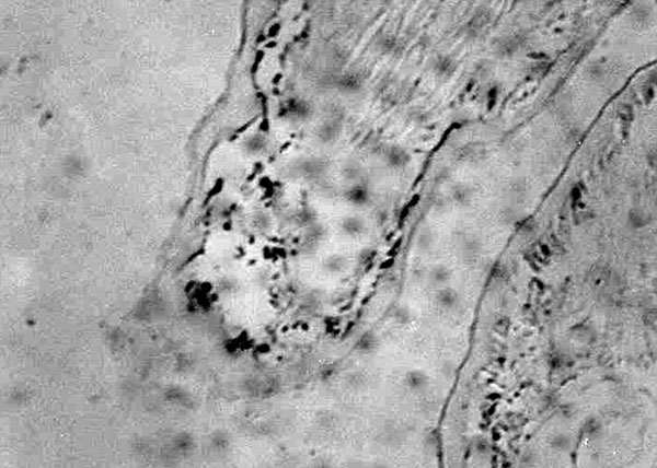 Microscopic image of the subcuticular tissue of the pleopod from a shrimp infected with the supernatant of the third passage of a human larynx carcinoma (Hep-2C) cell culture inoculated with an extract of shrimp infected with Taura syndrome virus. The presence of the virus is clearly visible by in situ hybridization as black spots after the samples were stained with Bismarck brown.