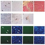 Thumbnail of In vivo West Nile virus capsid (Cp) expression induces apoptosis and inflammation in mice. TUNEL assay was performed on muscle cryosections harvested from mice injected with pcWNV-Cp-DJY (a) or pcDNA3.1 (b). Hematoxylin/eosin staining was performed on mouse tibialis muscle cryosections harvested from mice injected with pcWNV-Cp-DJY (c) or pcDNA3.1 (d) at 48 h postinjection (magnification: 200X [a, b] and 40X [c,d]). Immunohistochemical analysis was performed for detection of WNVCp-DJY protein expression in mouse brain injected with pcDNA3.1 or pcWNV-Cp-DJY as detected with horseradish peroxidase (HRP) (e,f, respectively). TUNEL assay on mouse brain cryosections harvested from pcWNV-Cp-DJY injected mouse was detected with HRP (g) (magnification: 300X [e–g]). Immunohistochemical studies were performed for detection of WNV-Cp-DJY protein expression in mouse brain injected with pcWNV-Cp-DJY or pcDNA3.1 as detected by fluorescein isothiocynate stain (h, i, and j, k, respectively). TUNEL assay on mouse brain cryosections harvested from pcWNV-Cp-DJY–injected mice (l,m) or pcDNA3.1-injected mice as detected with fluorescein isothiocyanate (n,o). WNV-Cp-DJY protein expressing His-positive cells or TUNEL-positive cells were visualized under ultraviolete microscope (h or l, respectively). Nuclear staining for WNV-Cp-DJY– or pcNDA3.1-transfected cells was visualized with appropriate filters (i, m or k, o, respectively) (magnification: 630X [h through o]).