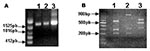 Thumbnail of Detection and restriction fragment length polymorphism taxonomic analysis of the Araçatuba virus ATI gene. Primers based on the ATI gene nucleotide sequence from the cowpox virus were used to amplify the gene. (A) The amplified fragments were resolved on 0.6% agarose gel with ethidium bromide. Line 1 shows Araçatuba virus; line 2 shows vaccinia virus; and line 3 shows cowpox virus, Brighton strain. (B) Products obtained after amplification were digested with XbaI restriction enzyme.