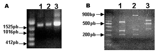 Detection and restriction fragment length polymorphism taxonomic analysis of the Araçatuba virus ATI gene. Primers based on the ATI gene nucleotide sequence from the cowpox virus were used to amplify the gene. (A) The amplified fragments were resolved on 0.6% agarose gel with ethidium bromide. Line 1 shows Araçatuba virus; line 2 shows vaccinia virus; and line 3 shows cowpox virus, Brighton strain. (B) Products obtained after amplification were digested with XbaI restriction enzyme. Fragments we