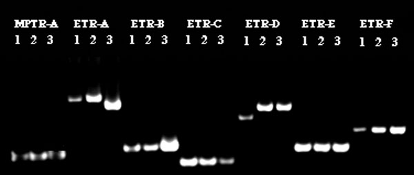 The variable number of tandem repeats results of three zero-copy IS6110 isolates with identical spoligotyping and polymorphic guanine cytosine-rich repetitive patterns. Seven VNTR loci are listed across the top. Second line represents the patient number of the isolates for each locus.