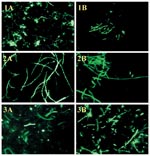 Thumbnail of Direct fluorescent-antibody (DFA) staining of Bacillus anthracis cells. Panel A (cell wall DFA) and Panel B (capsule DFA) correspond to 1) Positive control (B. anthracis Pasteur strain), 2) Test isolate #2002013601 (environmental specimen, 2001 U.S. anthrax outbreak), and 3) Clinical specimen #2002007069 (lung tissue of patient 1, 2001 U.S. anthrax outbreak), original magnification x 400.