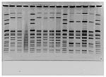 Thumbnail of Pulsed-field gel electrophoresis patterns of XbaI-digested multidrug-resistant Salmonella Newport. Lane 2, pattern MA-JJP0036; lane 3, pattern MA-JJP 0027; lane 6, pattern MA-JJP0062; lane 7, pattern MA-JJP0077; lane 8, pattern MA-JJP0089; lane 9, pattern MA-JJP0034; lane 11, pattern MA-JJP0050; lane 13, pattern MA-JJP0070.