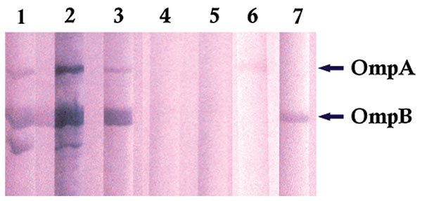 Immunoblot of Rickettsia africae antigens with R. africae–positive and –negative patient serum samples. Lanes 1–3: R. africae–positive patients’ serum samples; lanes 4–5: R. africae–negative patients’ serum samples; lane 6: anti–OmpA monoclonal antibody; lane 7: anti–OmpB monoclonal antibody.