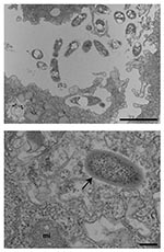 Thumbnail of A. Bosea sp. (isolate 3) in the process of being phagocytized by Acanthamoeba polyphaga (arrows) and in the extracellular media, as seen on electron microscopy. 8,900 x magnification. Bar represents 200 nm. B. Chryseobacterium-like rod (isolate 7) within A. polyphaga (arrows), as seen on electron microscopy. Arrow show the trilammelar membrane. mi = amoebal mitochondria. 36,000 x magnification. Bar represents 200 nm.