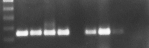 West Nile virus (WNV) reverse transcription-polymerase chain reaction results from epizootic die-offs in farm-raised alligators. The expected amplicon is 248 bp. Lane 1, a 100-bp molecular weight ladder. Lane 2, the positive WNV control. Lane 3, fresh tissue samples from a juvenile alligator in the 2002 epizootic. Lane 4, virus isolation cell homogenate from a juvenile alligator in the 2002 epizootic. Lane 5, horsemeat that was being fed to alligators during the 2002 epizootic. Lane 6, initial p