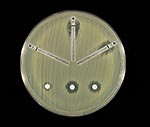 Thumbnail of Susceptibility testing of Enterobacter cloacae to carbapenems. Both methods had ill-defined zones of inhibition with inner colonies growing up to the disks or the E-test strips, respectively.