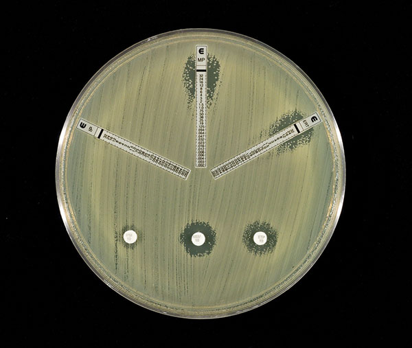 Susceptibility testing of Enterobacter cloacae to carbapenems. Both methods had ill-defined zones of inhibition with inner colonies growing up to the disks or the E-test strips, respectively.