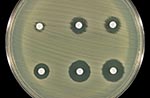 Thumbnail of Effect of addition of clavulanic acid (10 μL of 1,000 μg/mL) to the zones of inhibition of the three carbapenem disks. Top row (left to right): imipenem, meropenem, and ertapenem disks without clavulanic acid. Bottom row (left to right): imipenem, meropenem, and ertapenem disks with clavulanic acid.