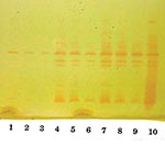 Thumbnail of Analytical isoelectric focusing (IEF) of serially diluted broth induced enzymes. The isoelectric points (pIs) of the two prominent bands midway and at the bottom of the gel are 6.9 and &gt;9.0. Lanes 1–3: uninduced enzyme serially diluted 1:1, 1:2, and 1:4. Lanes 4–6: enzyme induced with 8 μg/mL of cefoxitin serially diluted 1:1, 1:2, and 1:4. Lanes 7–9: enzyme induced with 4 μg/mL of imipenem serially diluted 1:1, 1:2 and 1:4. Lane 10: NOR-1 control, induced with 16 μg/mL of cefoxi