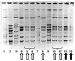 Thumbnail of Molecular epidemiology of group A streptococcal strains in outbreak 2. Pulsed-field gel electrophoresis, demonstrating relatedness of group A streptococcal isolates from facility staff and residents. Lanes 1 and 7 contain an ATCC quality control strain. Solid arrows denote identical strains from two of the three persons in whom fatal invasive group A streptococcal infection developed; the third person with invasive disease had an electrophoretically identical strain (not shown). Hol