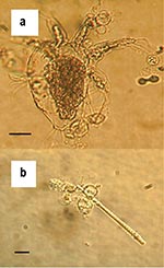 Thumbnail of Zoosporangia of strain 98-1810/3 visible as transparent spherical bodies growing in lake water on (a) freshwater arthropod and (b) algae. Bars = 30 μM.