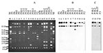 Thumbnail of Plasmid profile (A) and hybridization with CTX-M-9 probe (B) and CMY-2 probe (C). The studied isolates, by lane, are: 1: P5, 2: P6, 3: P6T (transconjugant of P6), 4: P9, 5: P10-1, 6: P12-1, 7: P12-2, 8: P14, 9: P15, 10: P18-1, 11: P19, 12: F2, 15: P10-2, 16: P18-2, 17: P18-2T (transconjugant of P18-2), 18: F3-1, 13, and 14: plasmid control strains E. coli 678 CECT (= NCTC 50193 with the following plasmid sizes: 54.38, 7.30, 5.56, 5.14, 3.98, 3.08, 2.71, and 2.06 kb) and E. coli 679