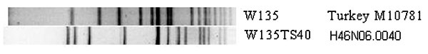 PFGE images of the case isolate (A) and the clone ET-37 (B).