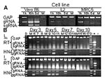 Thumbnail of Replication-specific multiplex reverse transcriptase–polymerase chain reaction (RT-PCR) assay shows severe acute respiratory syndrome–associated coronavirus (SARS-CoV) replicated in the lungs and intestines of mice. A. Vero E6, murine fibroblast (L2), and human lung fibroblasts (MRC5) were inoculated with SARS-CoV at an MOI of ≈ 0.001 or were mock-inoculated (M). G3PDH, SARS-CoV gRNA, and sgRNA were amplified by multiplex RT-PCR from total RNA extracted at 1 h, 16 h, or 5 days after