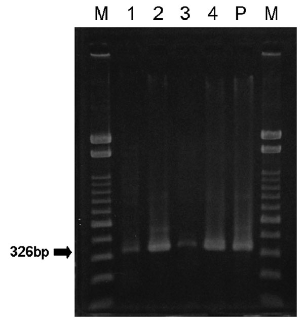 Detection of the Japanese encephalitis virus E gene in cerebrospinal fluid from patients with meningitis. Lanes 1–4, patients Numbers 1–4; lane P, positive control (JaGAr#01); lane M, marker (100-bp ladder).