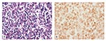 Thumbnail of Absence of reaction by in situ hybridization (ISH) to the digoxigenin (DIG)-labeled Taura syndrome virus (TSV) probes within the BGMK cells harvested at day 7 postinjection with TSV. A) No cytopathic effect suggestive of TSV infection was evident by conventional hematoxylin/eosin-phloxin (H&amp;E) histology (H&amp;E stain; 100x). B) Consecutive histologic section to that shown in 4A, but subjected to ISH with DIG-labeled TSV probes specific for TSV. No reaction to TSV is apparent in