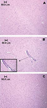 Thumbnail of Brainstem section of sham-inoculated control rat, showing the absence of an inflammatory response (A). Vascular and perivascular infiltration of mononuclear cells within the brainstem of a Florida cotton rat 7 days after infection with 3.2 log10 PFU/mL EVEV strain FE4-71k; inset enlarged to show cell infiltration (B). Cortex of cotton rat 5 weeks after infection, showing absence of inflammatory response (C). Animals in panels A and B were anesthetized with pentobarbital and perfused