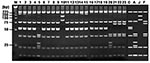 Thumbnail of Restriction fragment length polymorphism analysis of H1 products amplified with multiplex-nested primer set from seropositive sera. Ethidium bromide–stained polyacrylamide gels of AluI restriction endonuclease digestion of ≈420 bp rickettsial DNA amplified by using the nested primer H set WJ77/80 in the primary reactions and WJ79/83/78 in the nested reactions. Lanes: M, size marker DNA (25-bp DNA ladder); 1–18: H1–H18; 19–23: H20–24; C, R. conorii; A, R. akari; J, R. japonica; F, R.