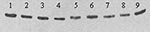 Thumbnail of Western blot showing differing mobility of E proteins from nine plaque-purified variants of West Nile virus (WNV) strain TM-171 Mex03. Nucleotide sequencing of strains in lanes 5 to 9 indicated the presence of an “NYS” glycosylation motif at residues 154 to 156 of E, while strains in lanes 1 to 4 encoded “NYP.” Antigens were separated in a nonreducing 5%/10% discontinuous sodium dodecyl sulfate–polyacrylamide gel, transferred to 0.2 μm nitrocellulose and detected with WNV-specific m