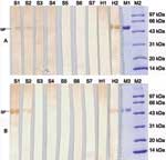 Thumbnail of Detection of antibodies against severe acute respiratory syndrome (SARS)–associated coronavirus recombinant proteins in animal sera by Western blotting. Recombinant nuleocapsid protein in panel A (NP, 54 kilodaltons [kDa]) and partial spike protein in panel B (SP, 57 kDa) were used as antigens. Goat anti-swine immunoglobulin G horseradish peroxidase was used as a secondary antibody. Serum samples from a convalescent SARS patient and healthy persons were used as positive and negative