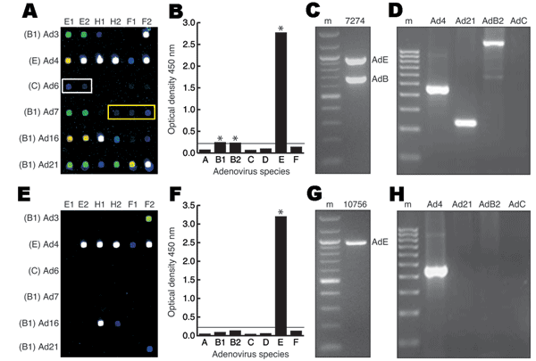 Molecular methods used to identify human adenovirus (HAdV) co-infections. A–D) Vaccinated sample 7274. A) Microarray hybridization profile. White and yellow rectangles indicate low-positive HAdV-C and HAdV-B2 targets, respectively. Spot colors denote hybridization signal intensity (white > yellow > green > blue). Species and corresponding serotype designations are indicated on the left. Probe designations (E1, E2 = serotype-specific E1A probes; H1, H2 = serotype-specific hexon probes; F