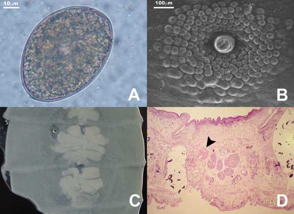 A) Diphyllobothrium latum egg. Note opercular constriction. B) Genital papillae of mature proglottids as seen under scanning electron microscope. C) Uterine loops of gravid proglottids in fresh preparation. D) Sagittal section of the genital pore region stained with hematoxylin-eosin. Note seminal vesicle (arrowhead) situated dorsocaudal to the cirrus sac (magnification 100×).