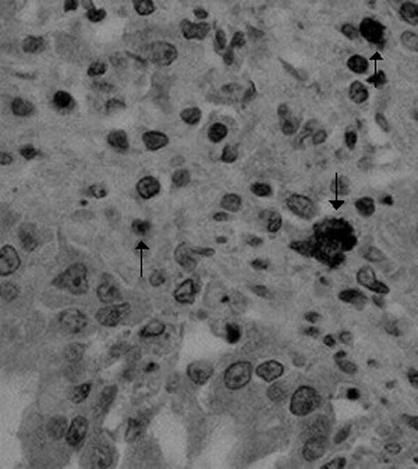 Immunohistochemical detection of canine coronavirus antigen (arrows) in canine lung tissue by a specific monoclonal antibody (magnification ×400).