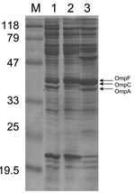 Thumbnail of Outer membrane protein (OMP) profiles of Escherichia coli strains. OMP content was determined by using sodium dodecyl sulfate–polyacrylamide gel electrophoresis. Lane 1 corresponds to E. coli CO clinical isolate; lane 2, E. coli JF 568 strain expressing OmpC; lane 3, E. coli JF 701 strain lacking OmpC (9). The molecular mass marker (M) and corresponding sizes (in kilodaltons) are indicated on the left. Horizontal arrows on the right indicate positions of the OMPs OmpF, OmpC, and Omp