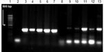 Thumbnail of Results of herpes simplex virus (HSV) type 1 and type 2 PCRs in postmortem specimens. Lane 1, 100-bp DNA ladder; lane 2, negative control HSV-1; lane 3, positive control HSV-1; lane 4, tracheal aspirate HSV-1; lane 5, liver HSV-1; lane 6, lung HSV-1; lane 7, stomach HSV-1; lane 8, negative control HSV-2; lane 9, positive control HSV-2; lane 10, tracheal aspirate HSV-2; lane 11, liver HSV-2; lane 12, lung HSV-2; lane 13, stomach HSV-2.