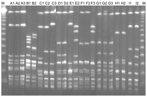 Pulsed-field gel electrophoresis profiles of all isolates from patients with recurrent group G streptococcal bacteremia. Isolates B1 and B2, Streptococcus canis; other isolates, S. dysgalactiae subsp. equisimilis (see designation of the isolates in Table 2). Lane M, molecular mass marker.