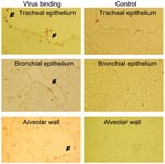 Thumbnail of Binding of fluorescein isothiocyanate–labeled influenza (H5N1) virus to formaldehyde-fixed, paraffin-embedded tissue slides of dog respiratory tract tissues. Left panel shows binding of virus (arrow). Right panel shows blocking of virus binding by competitive binding of Maackia amurensis lectin to sialic acid α2,3 galactose.