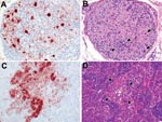 Thumbnail of Highly pathogenic avian influenza virus (H5N1) infection in tufted ducks. A) Neurons and satellite cells in a mesenteric ganglion expressing abundant influenza virus antigen. B) Ganglioneuritis in the same mesenteric ganglion, characterized by neuronal necrosis (arrows) and lymphocyte infiltration (between arrowheads). C) Expression of influenza virus antigen in medullary and cortical cells of an adrenal gland and D) focal necrosis, characterized by hypereosinophilia, pyknosis, and vacuolization (between arrowheads). Original magnification ×100. Tissues were stained either by immunohistochemistry that used a monoclonal antibody against the nucleoprotein of influenza A virus as a primary antibody (A, C) or with hematoxylin and eosin (B, D).