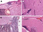 Thumbnail of Main histopathologic finding of neurobrucellosis in Stenella coeruleoalba. A) Mononuclear infiltrates in the meninges (arrow) surrounding the spinal cord; B) mononuclear infiltrate around vessels (arrow) of the cerebellum; C) mononuclear infiltrate (arrow) in the meninges around the brain; D) hyperemic vessels and mononuclear cell infiltrate in the meninges around the cerebellum (arrow). The insets correspond to amplified sections of each figure demonstrating the mononuclear cell infiltrate.