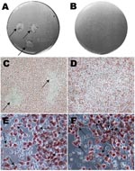 Thumbnail of Photographs and optical microscopy views of the wells showing plaques formed by Chlamydia trachomatis F/IC-Cal3 (A, C, E) and no plaque formed by clinical F persistent strain (B, D, F). A) Single well showing 2 distinct plaques (indicated by arrows). B) Well showing no plaque morphology. C) and D) Optical microscopy image showing plaque areas with little or no neutral red staining (arrows) surrounded by viable cells stained red (magnification ×100). Higher magnification (×400) showed numerous cells that had been infected by reference strain F/IC-Cal3 (E) and the clinical persistent F strain (F).