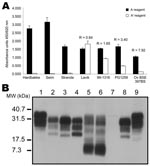 Thumbnail of Analysis of different ovine strains by ELISA typing test and immunoblot. A) ELISA typing test. Three Nor98 isolates (Fiksdal, Stranda, and Seim) were analyzed by using the ELISA typing test. Absorbances obtained in the classic A′typing reagent are close to 0, preventing calculation of the A/A′ratio. Ratios obtained for a Norwegian scrapie isolate (Lavik) and for the 3 internal controls (classic Scr 99–1316, intermediate scrapie PG1259, and experimental ovine bovine spongiform encephalopathy [BSE] 397 BS) are indicated. B) Pattern of migration of different ovine strains. Lanes 1 and 9, untreated negative brain homogenate. Lanes 2–8, proteinase K–treated brain homogenates: French scrapie isolate 99–1316 (lane 2); experimental ovine BSE 397 BS (lanes 3 and 8); Norwegian scrapie isolate (Lavik) (lane 4); Nor98 Stranda and Nor98 Seim scrapie isolates (lanes 5 and 6, respectively); negative brain homogenate (lane 7). MW, molecular weight.