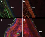 Thumbnail of Raccoon respiratory tissues stained with lectins specific for sialic acids (SAs) with α2,6- and α2,3-linkages. A) Upper trachea; B) lower trachea; C) bronchus; D) bronchiole. Arrows indicate endothelial lining of the tissues indicated. Green staining shows a reaction with fluorescein isothiocyanate–labeled Sambucus nigra lectin, which indicates SAs linked to galactose by an α2,6-linkage (SAα2,6Gal). Red staining shows a reaction with biotinylated Maackia amurensis lectin (detected w