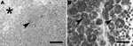 Thumbnail of A) Mesenteric lymph node of Yorkshire Terrier shows diffuse granulomatous lymphadenitis with extensive infiltration of macrophages, foci of pyogranulomatous inflammation (arrowhead), and focal necrosis (asterisk). Hematoxylin and eosin stain; scale bar represents 100 μm. B) Retropharyngeal lymph node of schnauzer shows innumerable acid-fast bacilli (arrows) within the cytoplasm of macrophages. Ziehl-Neelsen stain; scale bar represents 25 μm.