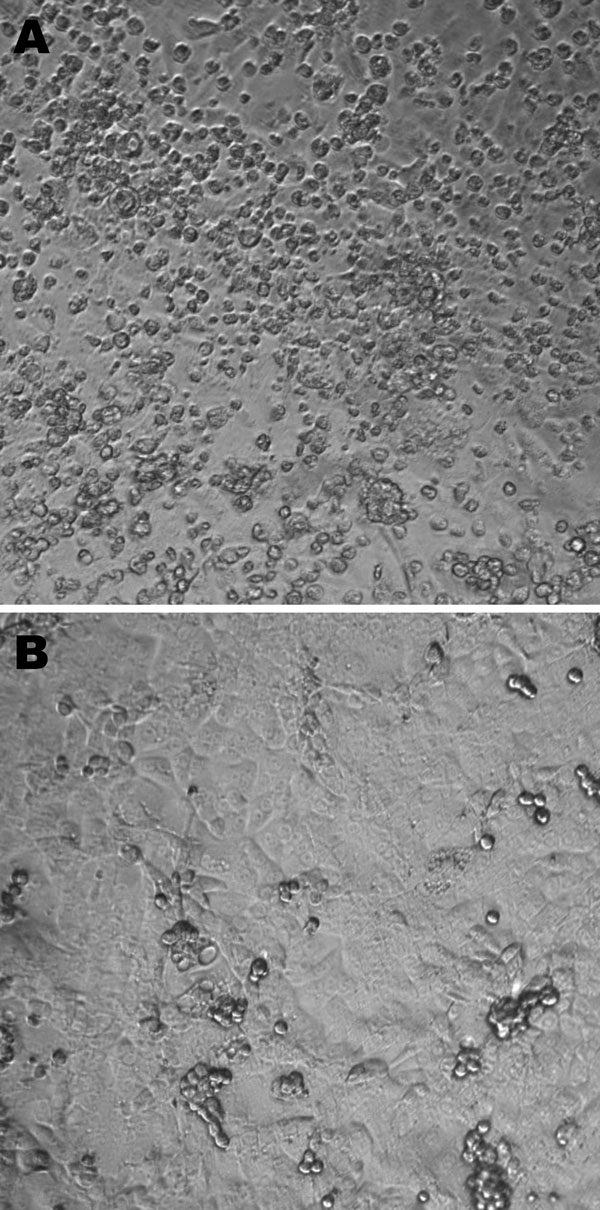 A) Cytopathic effects (round cells) observed 6 days after infection of rhesus monkey kidney (LLC-MK2) cells (second passage) with the Can112051-06 Saffold virus–like cardiovirus strain. B) Uninfected LLC-MK2 cells. Maginification ×10.