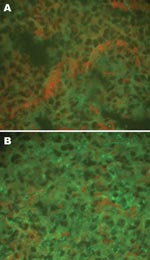 Thumbnail of Detection of hantaviral antigens by indirect immunofluorescent assay. A) Hantaviral antigen- negative Rattus norvegicus lung tissue, detected with anti-L99 and 76-118 hantavirus sera. B) Hantaviral antigen-positive R. norvegicus lung tissue, detected with anti-L99 and 76-118 hantavirus antibodies. Magnification ×400.