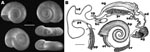 Thumbnail of A) Shell morphology of Biomphalaria tenagophila snail from Romania. Diameter of the shell was 10–14 mm. The sinistrally coiled, flat shells are yellow-brown, discoidal, deeply and symmetrically biconcave, and consist of 5 or 6 slowly increasing whorls. The last whorl is rounded; the intermediate whorls are slightly angled on the left side. The aperture is circular or slightly ovate and angled toward the left side of the shell (i.e., toward the upper surface on the bottom right shell). Fine, parallel, rib-like transverse lines can be seen on the outer surface of the whorls. A series of photographs were prepared by focusing on different levels of the structure and these were combined by CombineZ5 (www.hadleyweb.pwp.blueyonder.co.uk), using “do combine” and “do average and filter” commands. Scale bar = 3 mm. B) Reproductive system of B. tenagophila snail from Romania; ag, albumin gland; bc, bursa copulatrix; hp, distal part of the hepatopancreas; ng, nidamental gland; od, oviduct; ot, ovotestis; pp, preputium; pr, prostate; ps, penis sheath; sd, spermiduct; sv, seminal vesicles; vd, vas deferens; vp, vaginal pouch. B. tenagophila–specific characteristics (5): &gt;200 diverticulae of the ovotestis; 7–11 main lobes of the prostate; and presence of vaginal pouch. Scale bar = 1 mm.