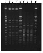 Thumbnail of Contour-clamped homogenous electric field electrophoresis of Staphylococcus aureus isolates. Lanes 2, 3, and 4 (Sma1 restriction): methicillin-resistant S. aureus (MRSA) isolated from Mrs A’s first infection, Mr A’s blood culture, and Mrs A’s second infection, respectively. Lanes 6, 7, and 8 (Apa1 restriction): MRSA isolated from Mrs A’s first infection, Mr A’s blood culture, and Mrs A’s second infection, respectively. Lanes 1, 5, and 9: S. aureus NCTC8325.