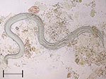 Thumbnail of Adult female of Strongyloides stercoralis collected in bronchial fluid of a patient with disseminated disease. Scale bar = 400 µm.